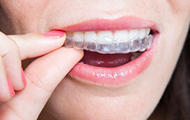 woman putting in invisalign