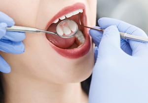 Woman getting a dental exam 