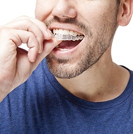 man putting invisalign clear braces on his teeth