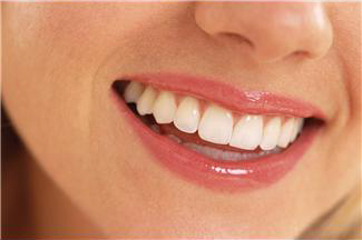 porcelain-veneers-purcellville