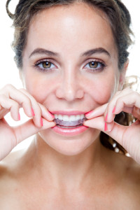 Adult braces in Herndon can improve your oral health.